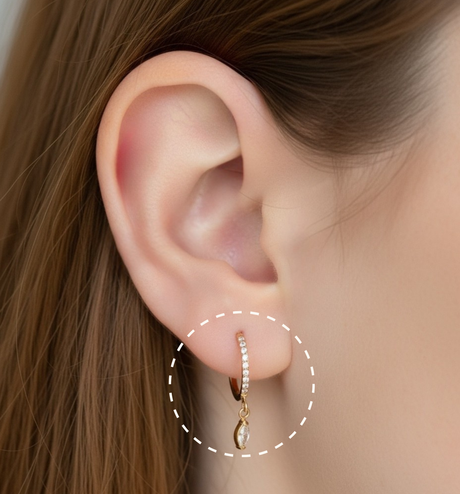 LOBE