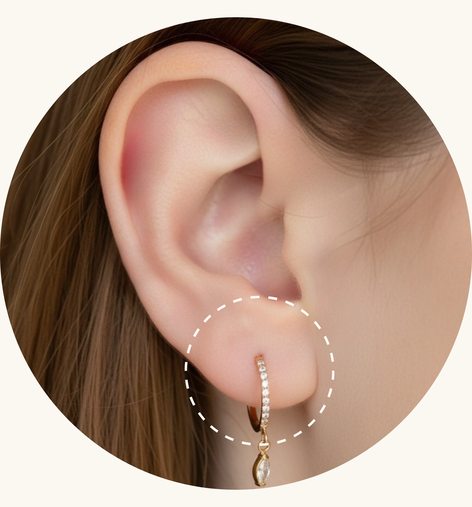lobe